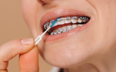 Clear Aligners vs. Metal Braces: The Adult’s Guide to Straightening Teeth