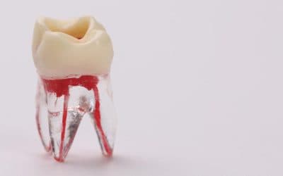 Top 5 Signs You Might Need a Root Canal (And Why It’s Not Scary)