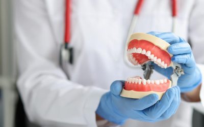 The Ultimate Guide to Dental Implants: Everything You Need to Know